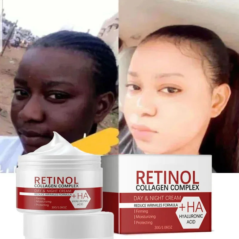 Dark Spot & Acne Removal Collagen Skin Lightening Cream
