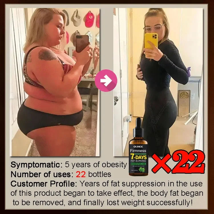 Natural Weight Loss Oil - Belly Fat Burning Cream with Green Tea & Grape Extract