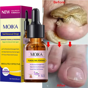 Fungal Nail Treatment Serum - Fast-Acting Repair Gel for Nail Fungus & Infections