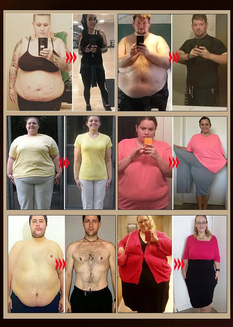 Natural Weight Loss Oil - Belly Fat Burning Cream with Green Tea & Grape Extract