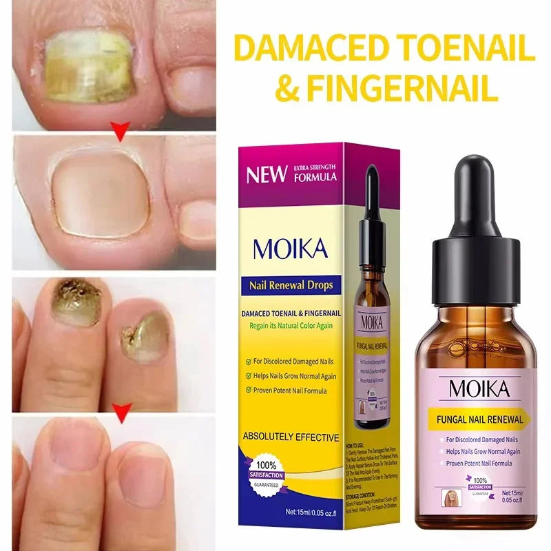 Fungal Nail Treatment Serum - Fast-Acting Repair Gel for Nail Fungus & Infections