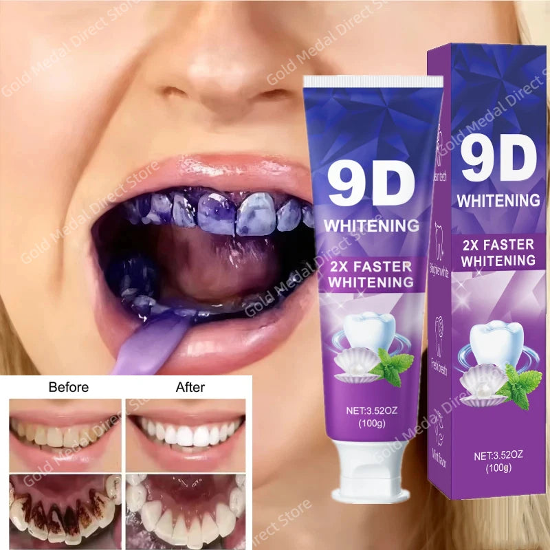 💜 43% OFF! Purple Teeth Whitening Toothpaste - Color Correcting Formula for Instant Brightness