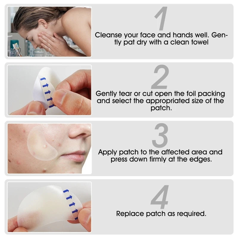 20 Patches Acne Patch Pimple Patches Blemish Protective Cover Absorbing Spot Hydrocolloid Dressing Zit Drop Shipping