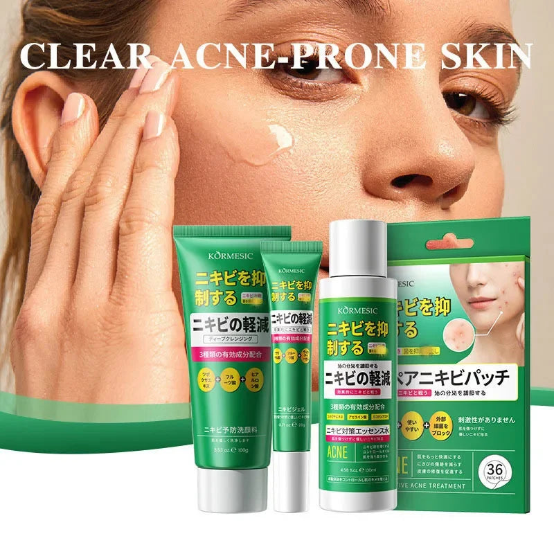 Salicylic Acid Acne Treatment Cream - Deep Pore Cleansing & Oil Control