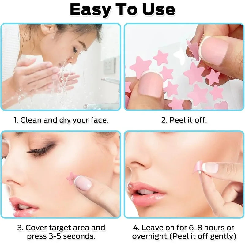 200-Piece Colorful Acne Patches - Waterproof Hydrocolloid Pimple Stickers
