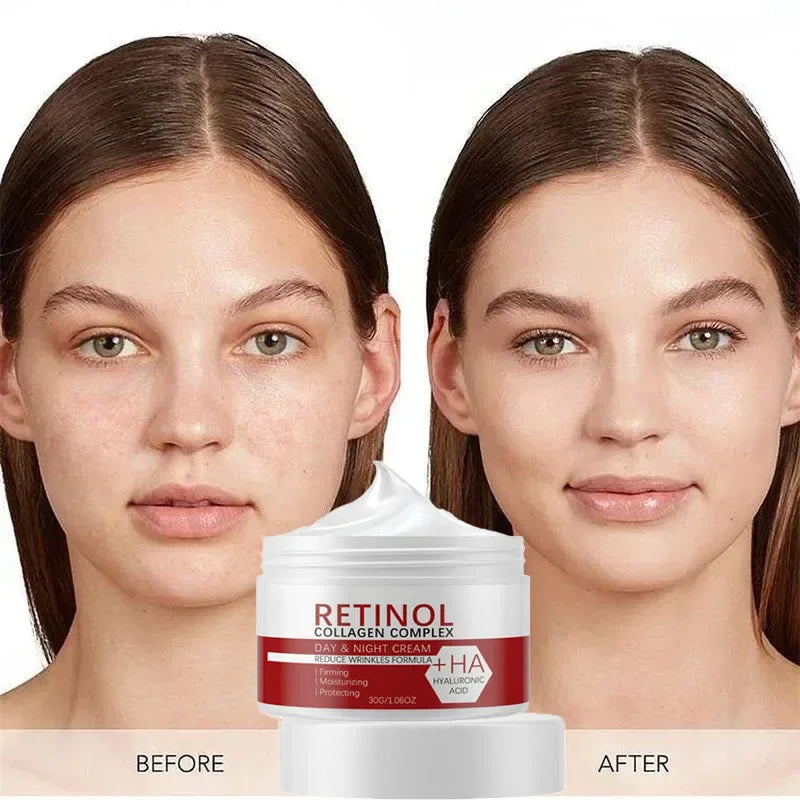 Dark Spot & Acne Removal Collagen Skin Lightening Cream