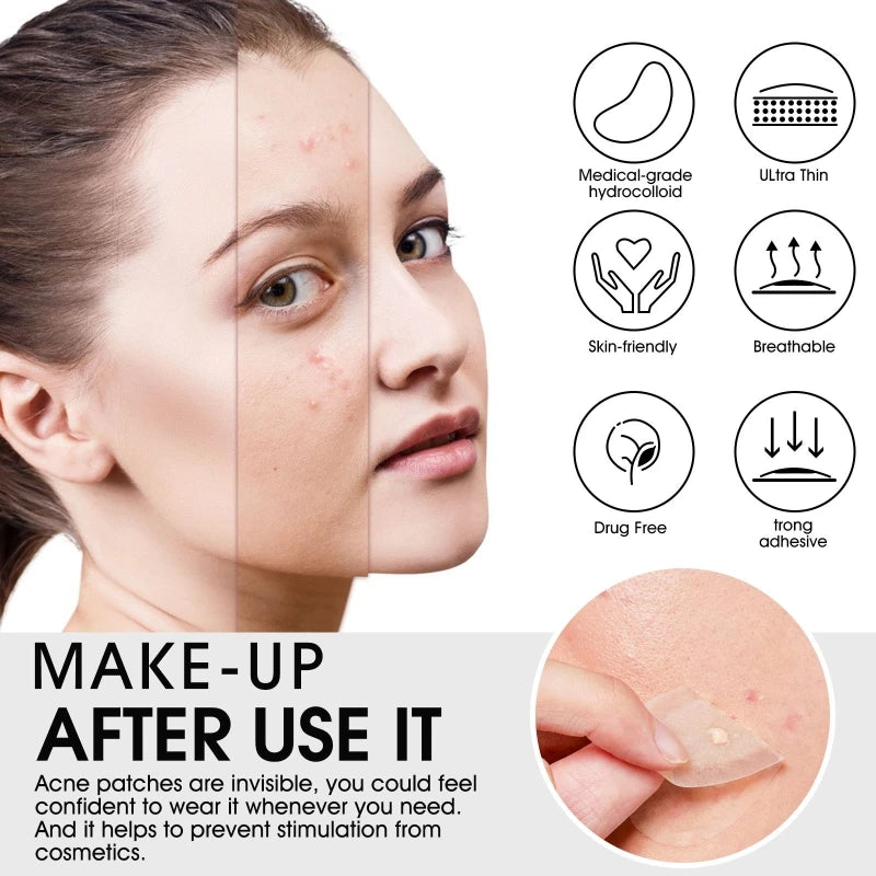20 Patches Acne Patch Pimple Patches Blemish Protective Cover Absorbing Spot Hydrocolloid Dressing Zit Drop Shipping