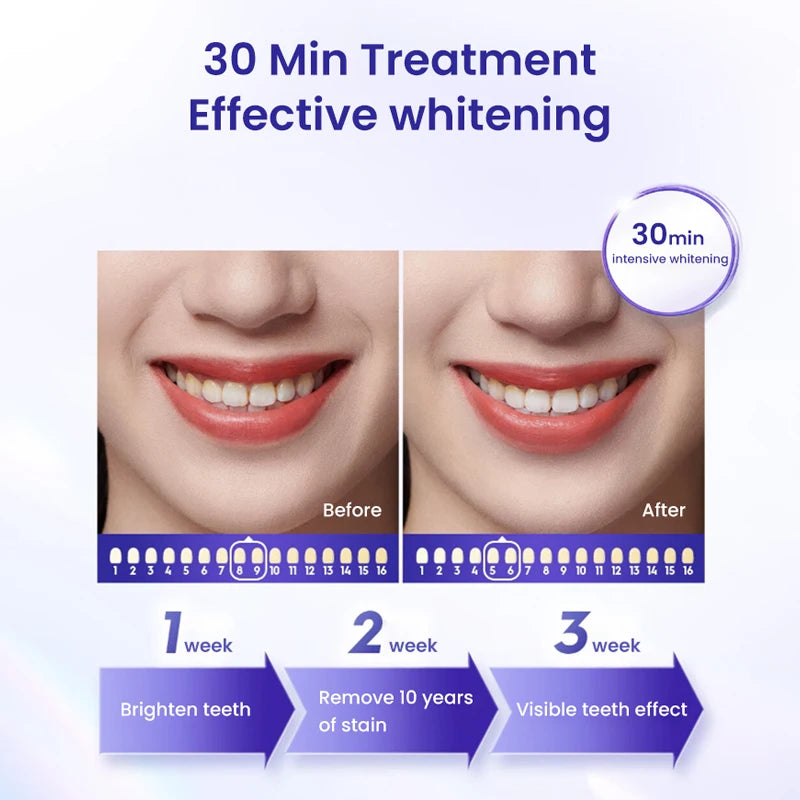 Crest 3D Whitestrips Dental Whitening Kit 3D White Professional Effects Tooth Oral Hygiene Care Teeth whitening products