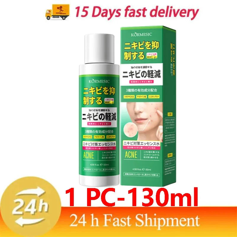 Salicylic Acid Acne Treatment Cream - Deep Pore Cleansing & Oil Control