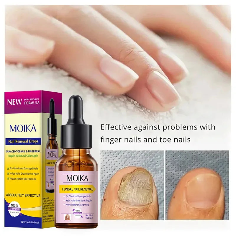 Fungal Nail Treatment Serum - Fast-Acting Repair Gel for Nail Fungus & Infections