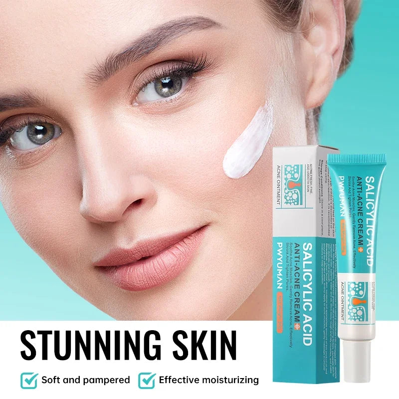 Salicylic Acid Acne Treatment Cream - Pore Shrinking, Oil Control & Brightening