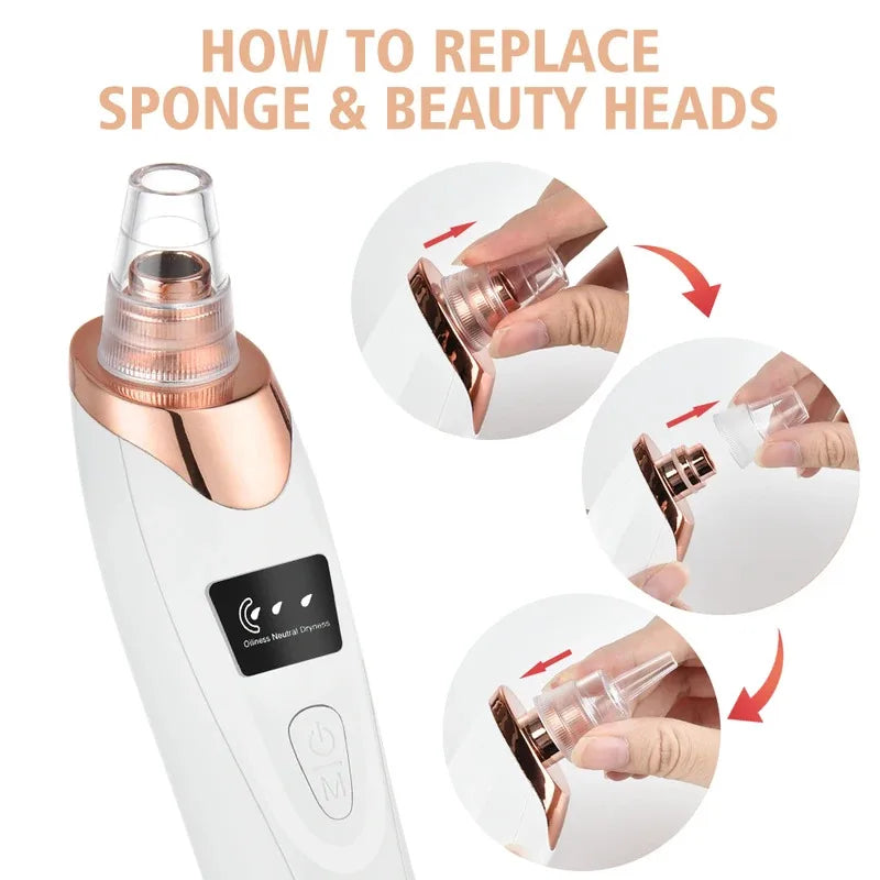 Electric Blackhead Remover Vacuum with 3 Suction Levels & 5 Heads
